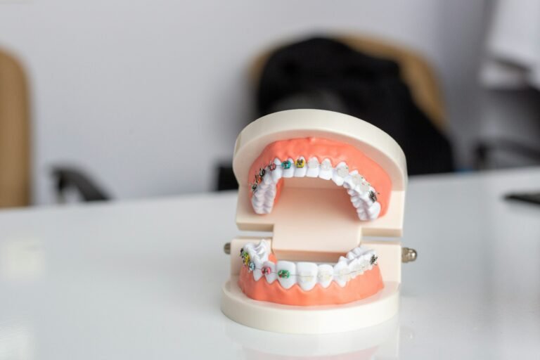 bague-dentaire