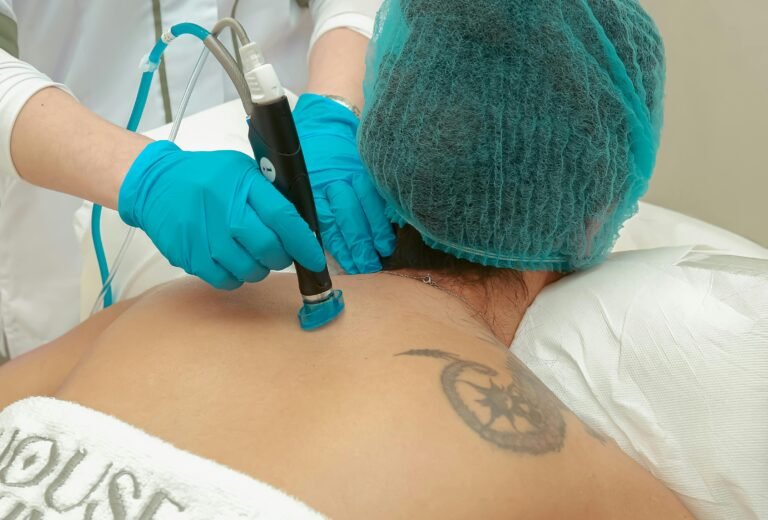 elle-se-fait-enlever-un-tatouage